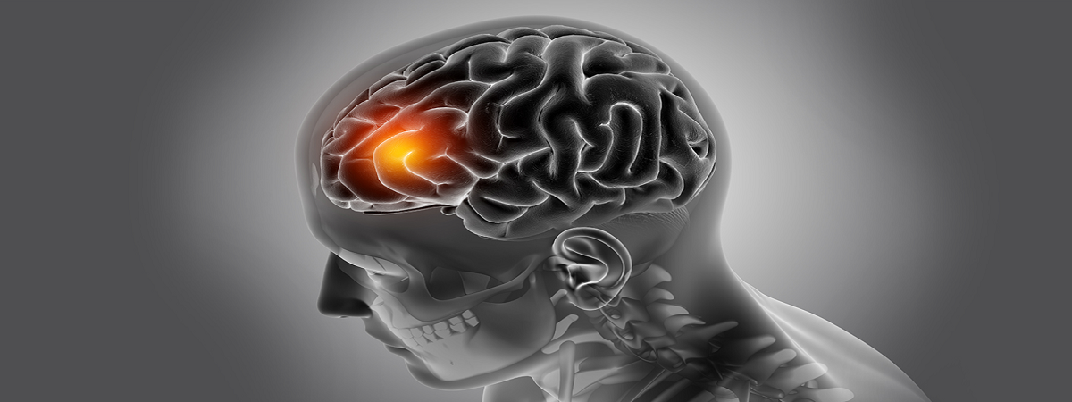 World Brain Cancer Day